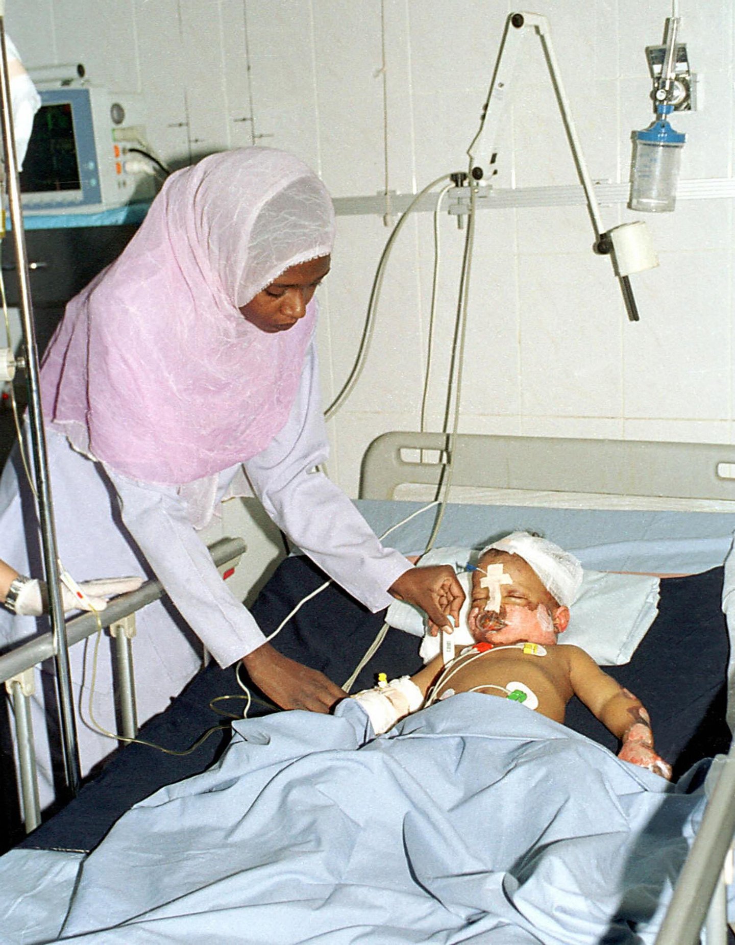 Three-year-old Sudanese boy Mohammed al-Fateh, the sole survivor of a Sudan Airways plane crash near the eastern city of Port Sudan, is treated at a Khartoum hospital 09 July 2003. Doctors were mystified as to how the boy, who was burned and lost part of a leg, had survived the previous day's crash near Sudan's Red Sea coast, speculating that he was thrown clear of the plane on a piece of wreckage and may have landed on a bush. The Sudan Airways Boeing 737 was destroyed in a ball of fire as it attempted to land back at Port Sudan after apparently suffering an engine problem soon after takeoff. (Film) AFP PHOTO/Salah OMAR (Photo credit should read SALAH OMAR/AFP/Getty Images)