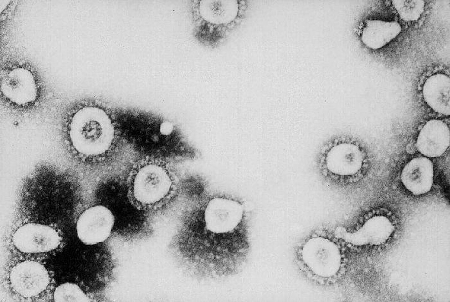 ATLANTA, GA - UNDATED:  This undated handout photo from the Centers for Disease Control and Prevention (CDC) shows a microscopic view of the Coronavirus at the CDC in Atlanta, Georgia. According to the CDC the virus that causes Severe Acute Respiratory Syndrome (SARS) might be a "previously unrecognized virus from the Coronavirus family."  (Photo by CDC/Getty Images)